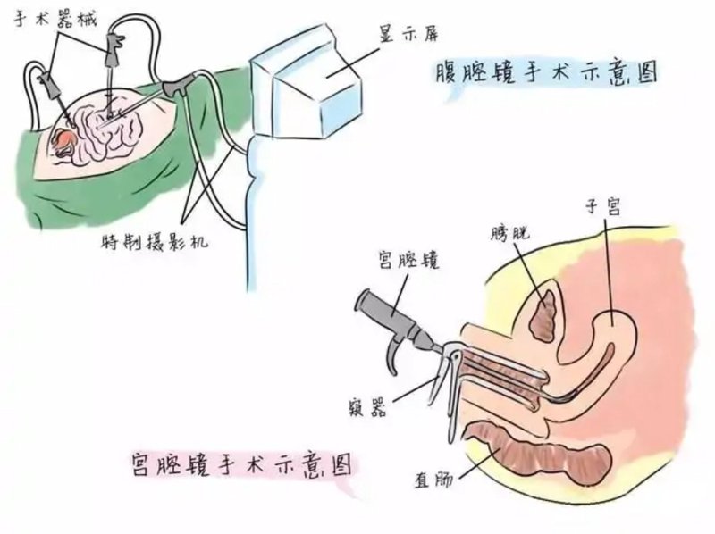 赤峰妇科医院：守护女性健康的小卫士